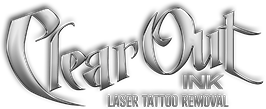 Clear Out Ink Laser Tattoo Removal